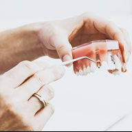 Hands holding a dental implants and teeth model